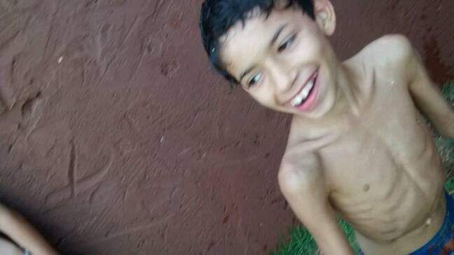 Samuel antes do tratamento